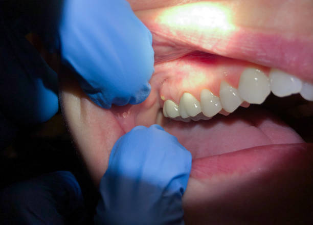 Best Emergency TMJ Treatment in Weatherford, OK